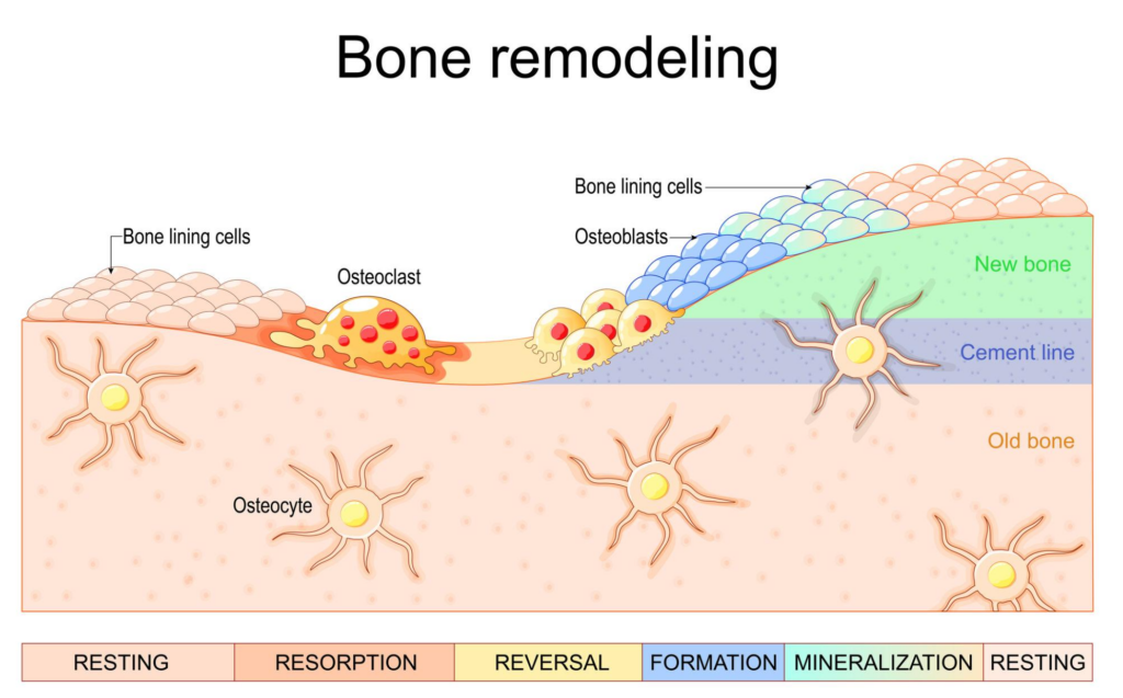 Diagram of bone remodeling showing resting, resorption, reversal, formation, mineralization, and resting phases with osteoclasts resorbing old bone and osteoblasts forming new bone on the surface of a bone cross-section.
